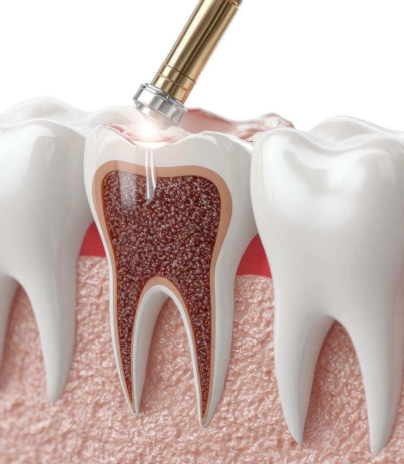 Endodoncija