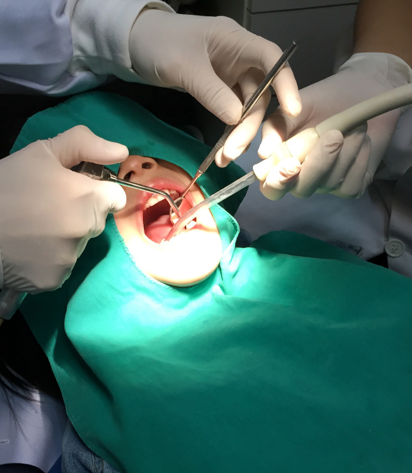 oralna hirurgija
